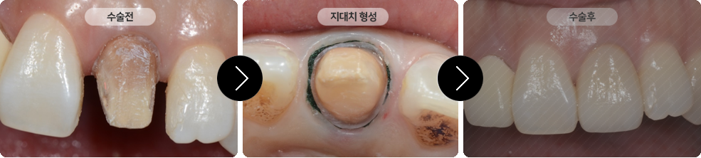 이미지명